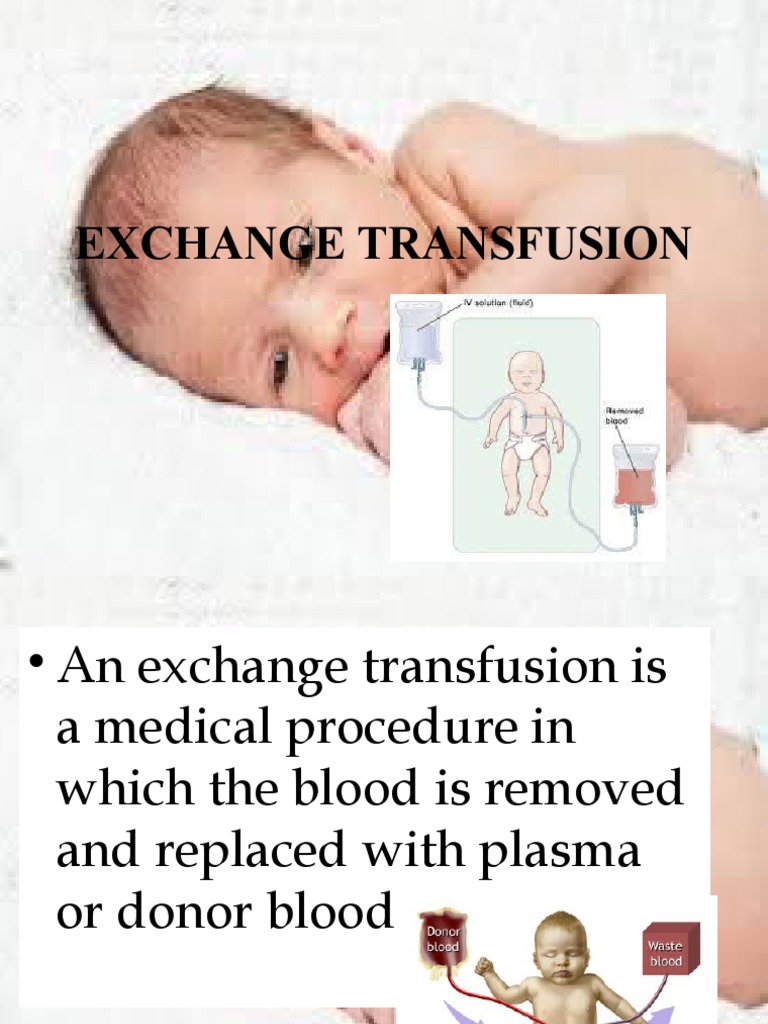 Exchange Transfusion for Jaundiced Newborns in the United States | Embryo Project Encyclopedia