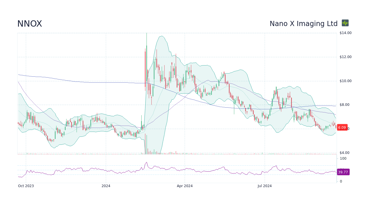 NNOX | Nano-X Imaging Ltd. Analyst Estimates | MarketWatch